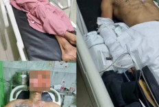 Korban Ledakan Tungku di PT San Xiong Steel Indonesia Meninggal Dunia Saat Dirawat di Rumah Sakit di Jakarta 